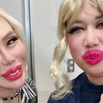 【アレンのWikiプロフ】整形男子アレン様とは?霜降り明星せいやは似てる?