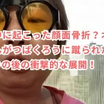 配信中に起こった顔面骨折？オリーブさんがつばくろうに蹴られた理由は？その後の衝撃的な展開！